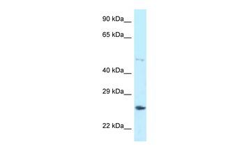 HNRNPF Rabbit Polyclonal Antibody