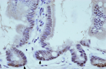 THOC1 Rabbit Polyclonal Antibody