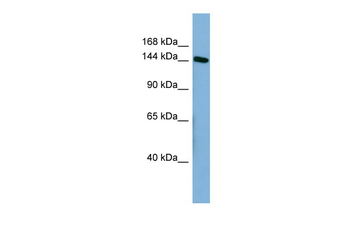 HDLBP Rabbit Polyclonal Antibody