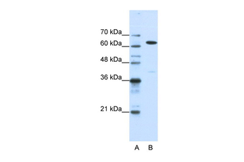NXF1 Rabbit Polyclonal Antibody