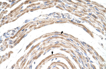 CPSF6 Rabbit Polyclonal Antibody