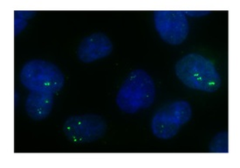 NONO Rabbit Polyclonal Antibody