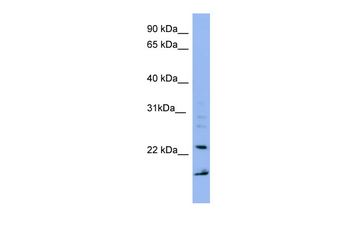 IMP3 Rabbit Polyclonal Antibody