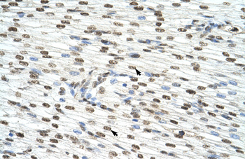 HNRPAB Rabbit Polyclonal Antibody