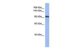 LARP1 Rabbit Polyclonal Antibody