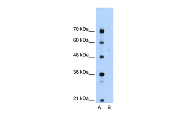SLA Rabbit Polyclonal Antibody