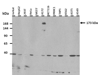 SYNJ1 Rabbit Polyclonal Antibody