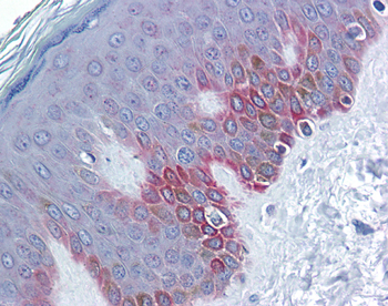 FZD5 Rabbit Polyclonal Antibody