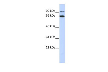 FZD10 Rabbit Polyclonal Antibody