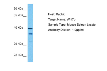 WNT7B Rabbit Polyclonal Antibody