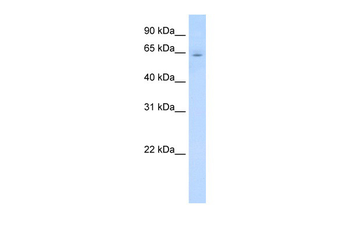 CYP2E1 Rabbit Polyclonal Antibody
