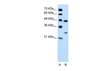 CLDN18 Rabbit Polyclonal Antibody