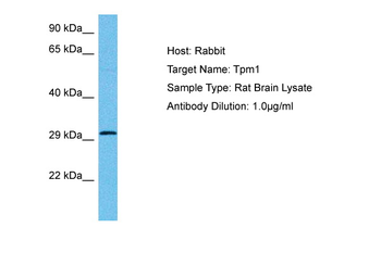 TPM1 Rabbit Polyclonal Antibody