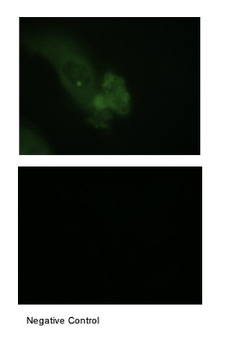 MUC1 Rabbit Polyclonal Antibody