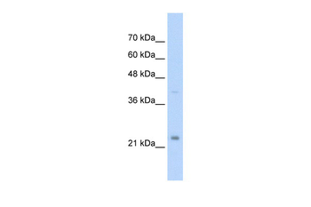 MUC1 Rabbit Polyclonal Antibody