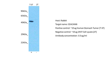 CEACAM6 Rabbit Polyclonal Antibody