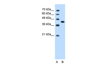 CEACAM6 Rabbit Polyclonal Antibody