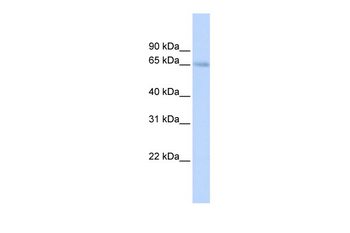 SLC22A6 Rabbit Polyclonal Antibody