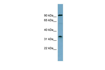 SDS Rabbit Polyclonal Antibody