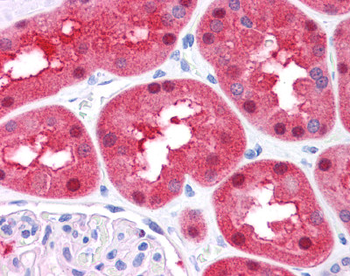 FAH Rabbit Polyclonal Antibody
