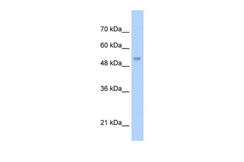 LCAT Rabbit Polyclonal Antibody