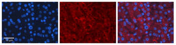 LCAT Rabbit Polyclonal Antibody