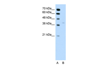 HSD17B1 Rabbit Polyclonal Antibody