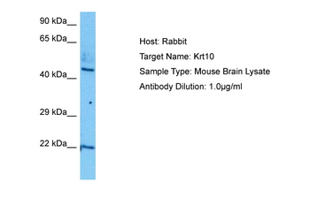 KRT10 Rabbit Polyclonal Antibody