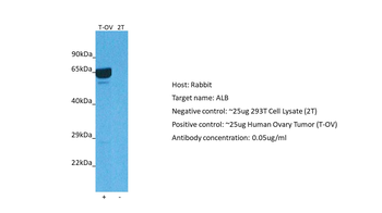 ALB Rabbit Polyclonal Antibody