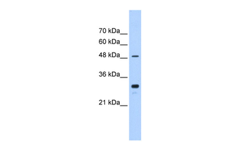 CYP2C9 Rabbit Polyclonal Antibody