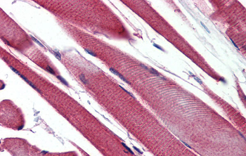 GSTM2 Rabbit Polyclonal Antibody