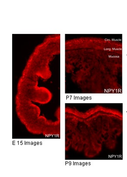 NPY1R Rabbit Polyclonal Antibody