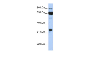 PTGS1 Rabbit Polyclonal Antibody