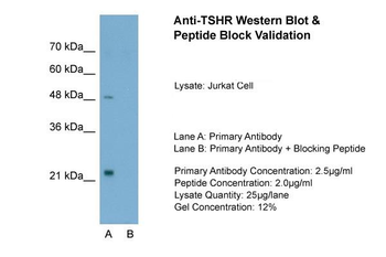 TSHR Rabbit Polyclonal Antibody