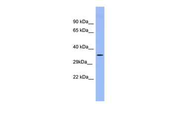 PSG5 Rabbit Polyclonal Antibody