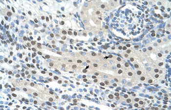 SEMG1 Rabbit Polyclonal Antibody