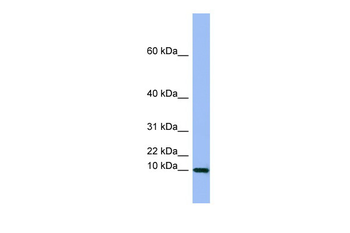 SEMG1 Rabbit Polyclonal Antibody