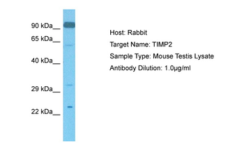 Timp2 Rabbit Polyclonal Antibody