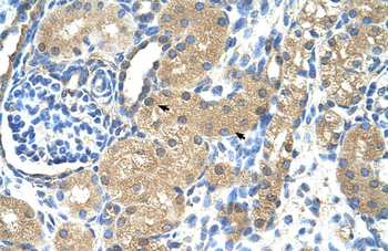 TNNI1 Rabbit Polyclonal Antibody