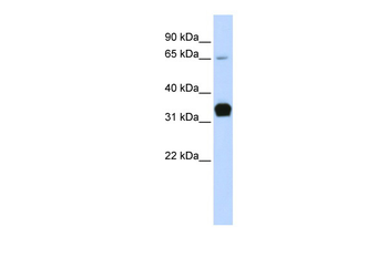 TNNT1 Rabbit Polyclonal Antibody