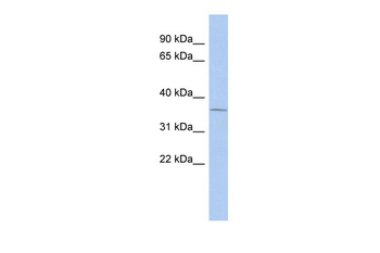 UPP1 Rabbit Polyclonal Antibody
