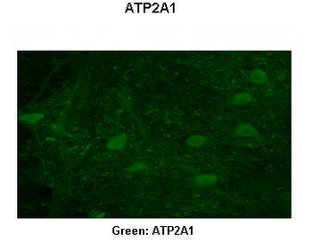 ATP2A1 Rabbit Polyclonal Antibody