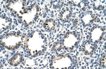 RAD23A Rabbit Polyclonal Antibody