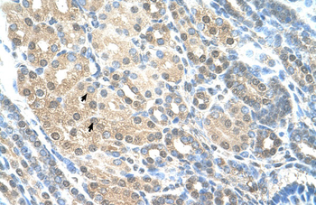RAD23A Rabbit Polyclonal Antibody