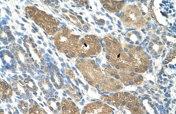 SLC1A5 Rabbit Polyclonal Antibody