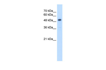 SLC1A5 Rabbit Polyclonal Antibody