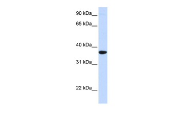 SCGN Rabbit Polyclonal Antibody