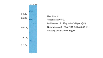 GTSE1 Rabbit Polyclonal Antibody