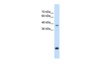 ASPN Rabbit Polyclonal Antibody