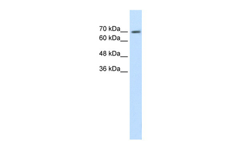 EPS8L1 Rabbit Polyclonal Antibody